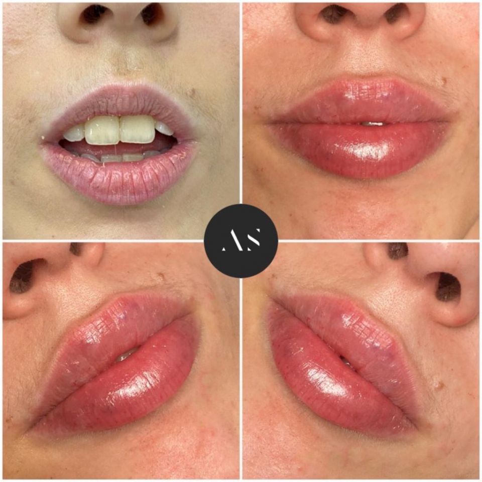 Dr Alejandro Segarra, artist, Facial Beauty By &lsquo;Drawing On Smiles, Madrid is a medical artist